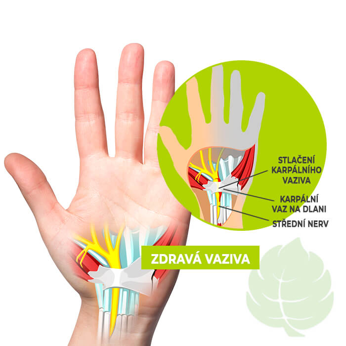 Mast Na Karpalni Tunel A Prirodni Vyrobky Na Karpaly